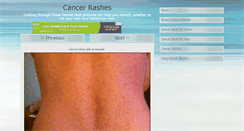 Desktop Screenshot of cancerrashpictures.com